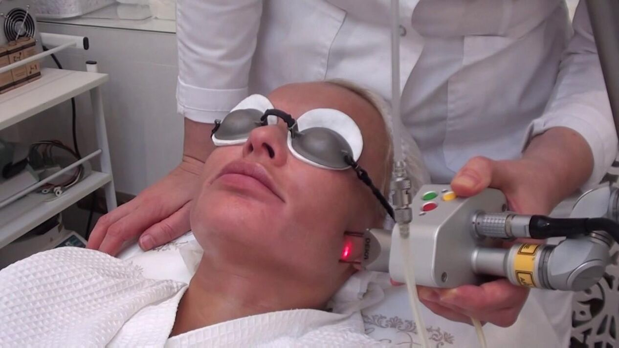Behandling med en laserstråle af problemområder i ansigtets hud